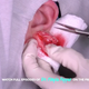 Illustration for article titled Dr. Pimple Popper Closes Holes in Earlobes But Leaves One in Our Hearts